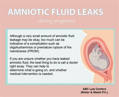 does leaking amniotic fluid smell|Leaking amniotic fluid (premature rupture of membranes)